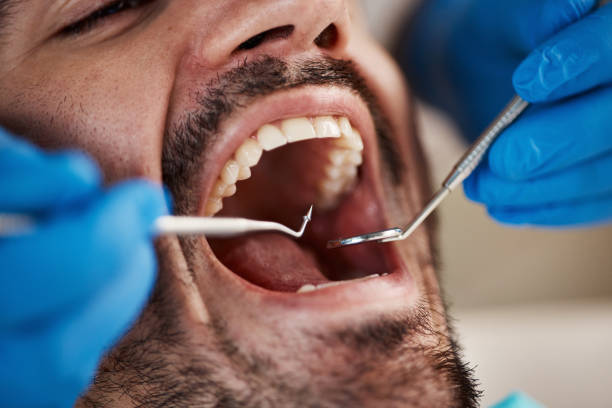 Best Emergency Denture Repair in Princeton, TX